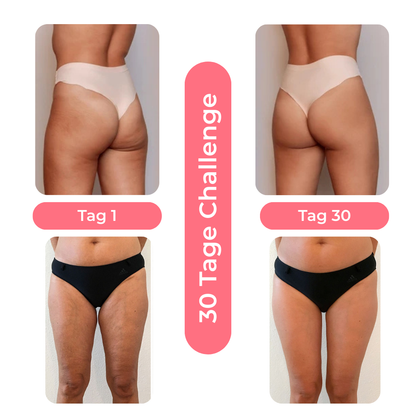 Anti-Cellulite Massagegerät