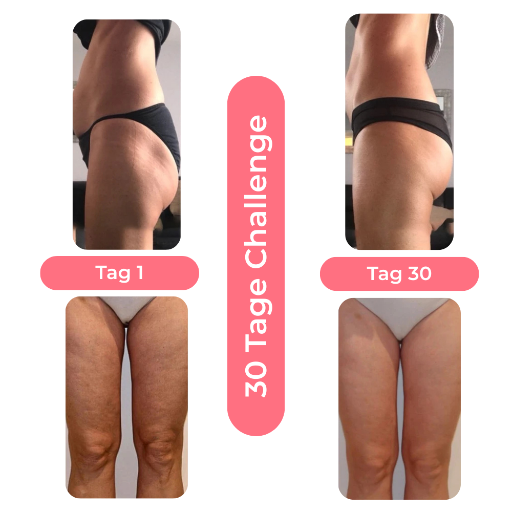 Anti-Cellulite Massagegerät