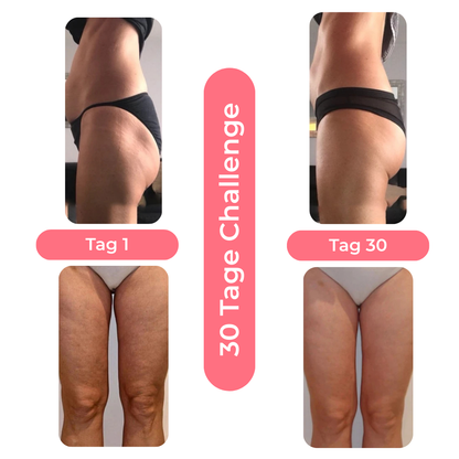 Anti-Cellulite Massagegerät