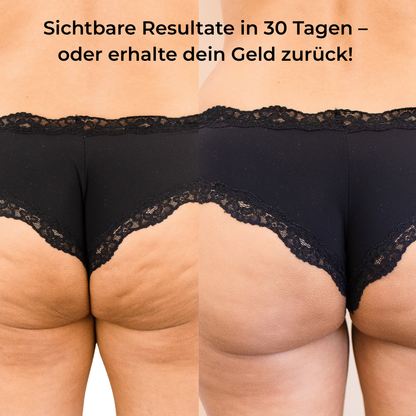 Anti-Cellulite Massagegerät